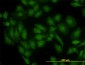 GLS Antibody (monoclonal) (M01)